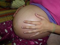 Umeduna edo haurduna